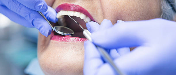 Best Broken or Cracked Tooth Emergency Dentist in USA